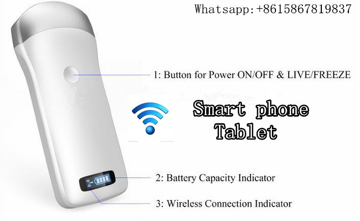 Integrated Portable Ultrasound Widely Used Wireless Probe
