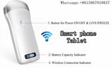 Integrated Portable Ultrasound Widely Used Wireless Probe