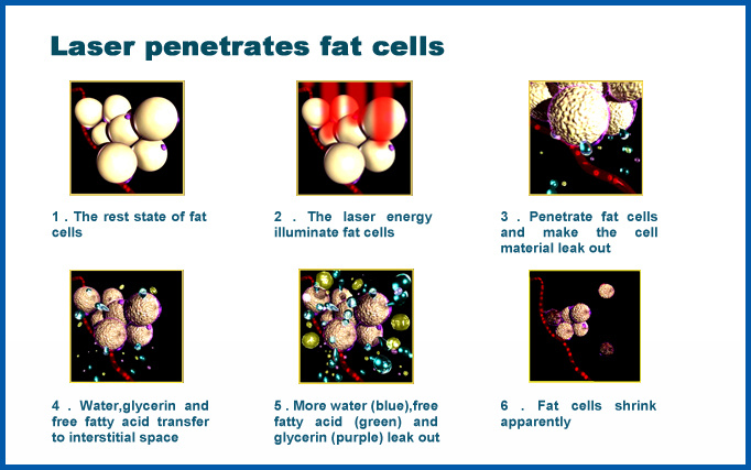 100% Good Feedback Cavitation RF Diode Laser Slimming Beauty Machine